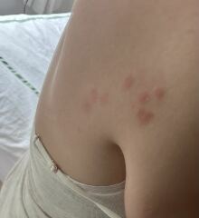 What on earth am I being bitten by? (Pics included)