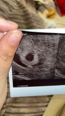 5 week scan…