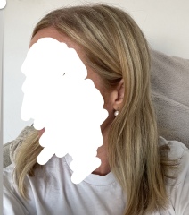 Are my highlights stripey?