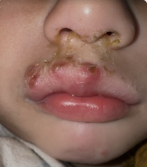 Dr not sure what this is, anyone’s LO had similar?