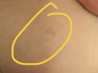Weird brown mole?