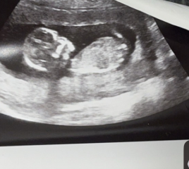 Baby nub