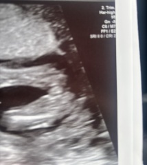 Potty shot confirmation