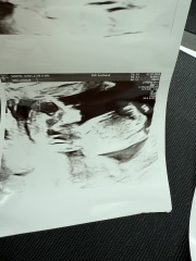 Boy or girl??