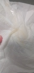 Is this discharge normal?