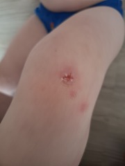 Is this a tonight emergency or can it wait to tomorrow?