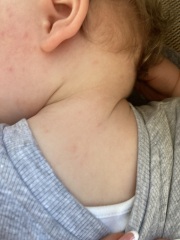 What does this look like to you? (Baby spots)