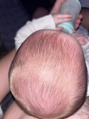 Does my baby have a flat head?