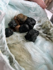 Black poop from 2 year old?