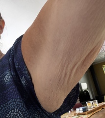 Mounjaro 10st or more to lose - Thread 5