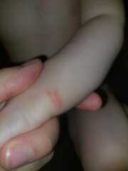 What is on my daughters wrist?