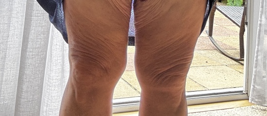 Mounjaro 10st or more to lose - Thread 5