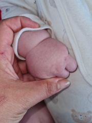 Baby breathing, subcostal retractions :(