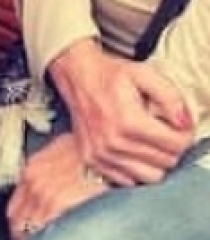 Do I need an antibiotic?