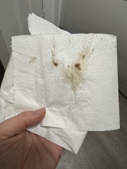Should I be worried?