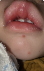 Dr not sure what this is, anyone’s LO had similar?