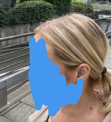Are my highlights stripey?