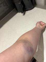 Blood test-is this normal (pic attached)