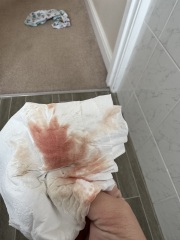 Bleeding in early pregnancy
