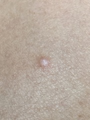 Does anyone know what this could be?