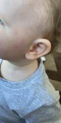What does this look like to you? (Baby spots)
