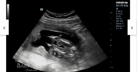 Is this definitely a boy?
