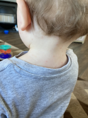 What does this look like to you? (Baby spots)
