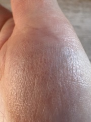 What’s this on my hands?