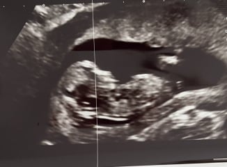 Anyone want me to take a look at their nubs?