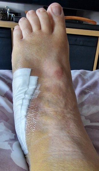 The Bluestocking does a late night flit again