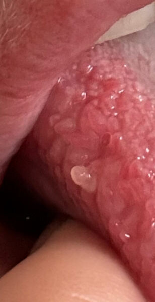 Why do I get these sore bits