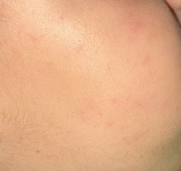 What are these spots?