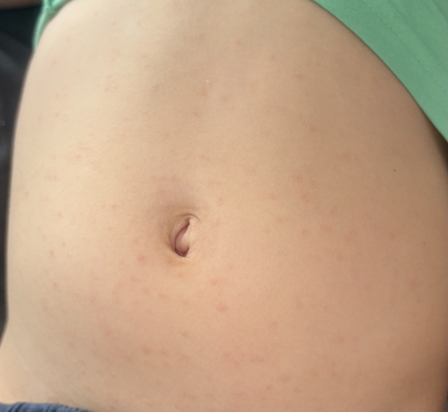 What are these spots?