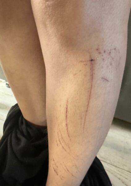 Would wear a skirt with these scratches?