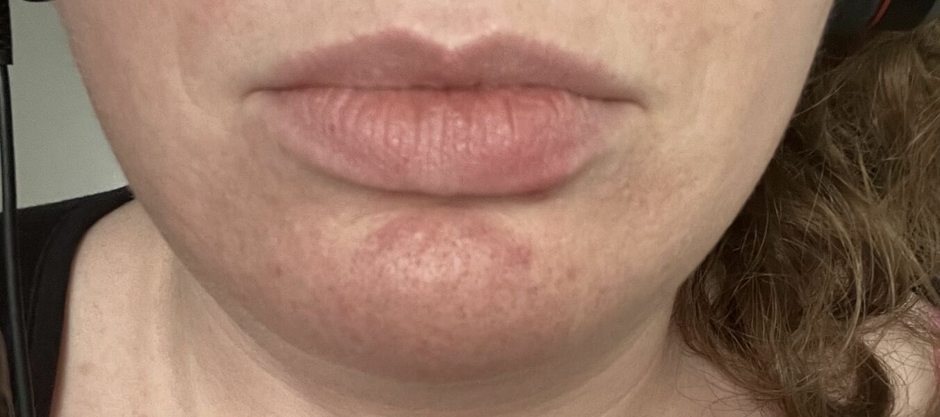 To wonder what’s going on with all the big lips