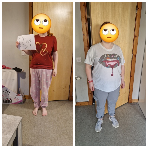 Anyone want to share their before and after pics?