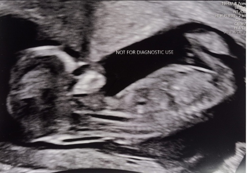 Due February 2026 - thread 2