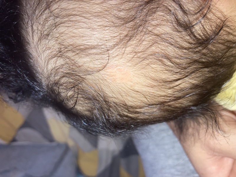 Help! What is this on baby’s scalp ??