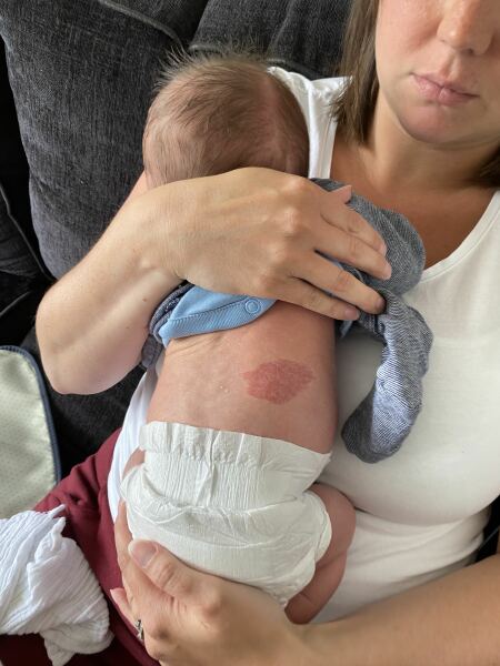Does anyone know what this mark is on my baby?