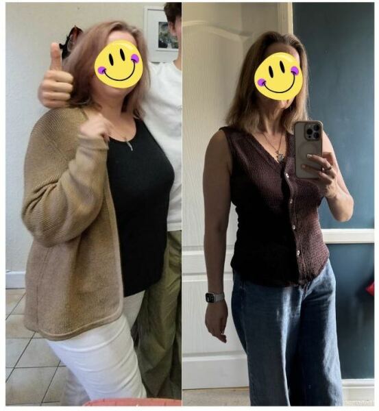 Anyone want to share their before and after pics?
