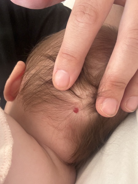 Does anyone know what this mark is on my baby?