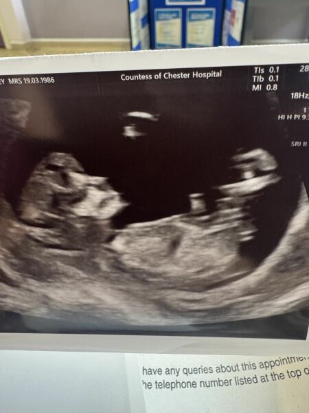 Due March 2026 🤍 pt 2