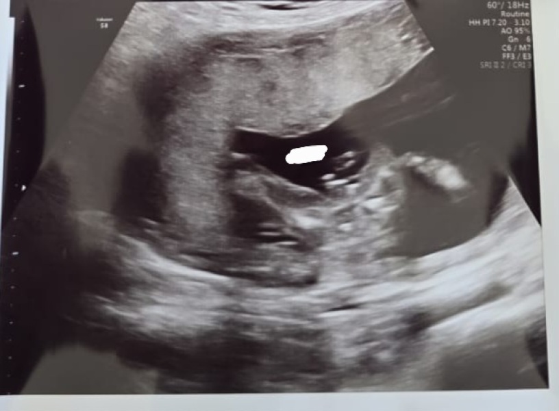 Girl or boy