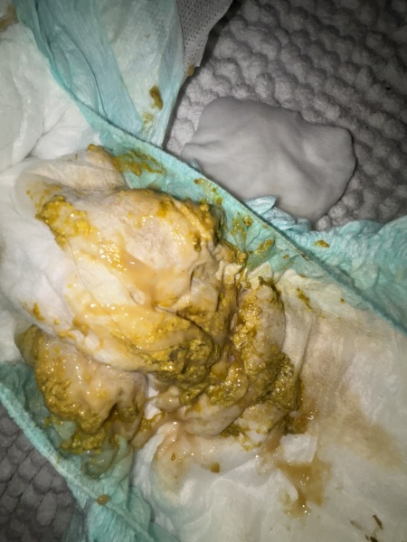 Teething poo or illness?