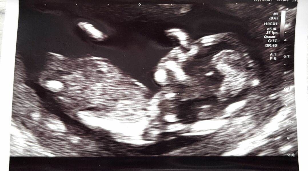 Gender guesses?