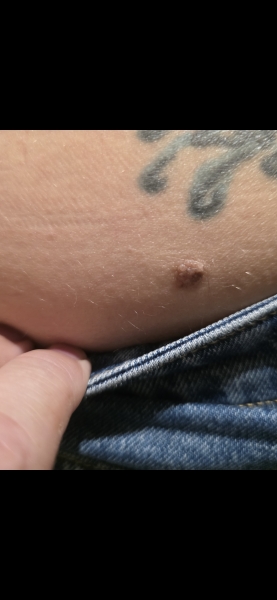 Moles