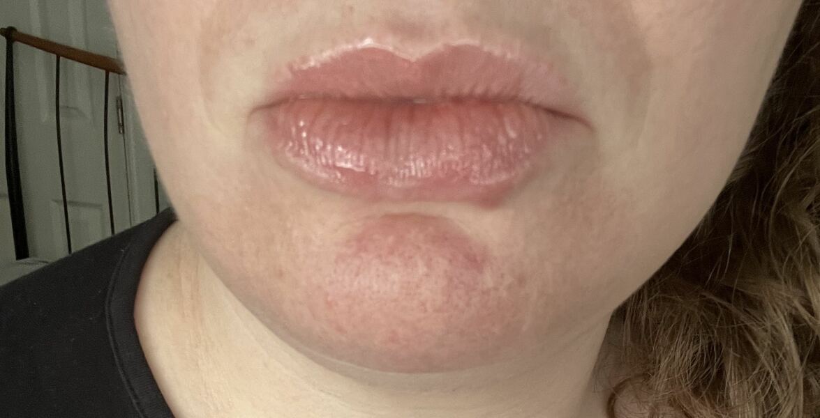 To wonder what’s going on with all the big lips