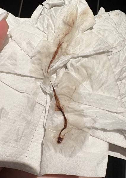 3rd month of ovulation bleeding