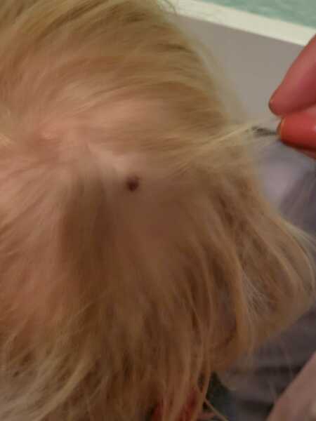 Mark on two year old's head?
