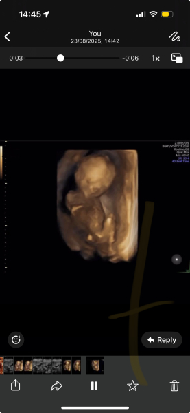 3d scan at 17 weeks 🥹🤍